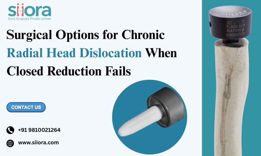  Surgical Options for Chronic Radial Head Dislocation: When Closed Reduction&nbsp;Fails.